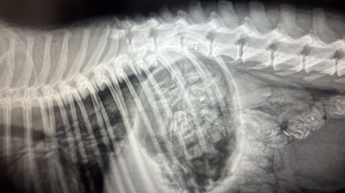 Ruptured back spine